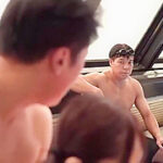 625-youth-with-areare-awd